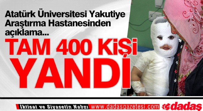 400 kişi yandı