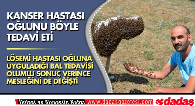 Kanser hastası oğlunu böyle tedavi etti